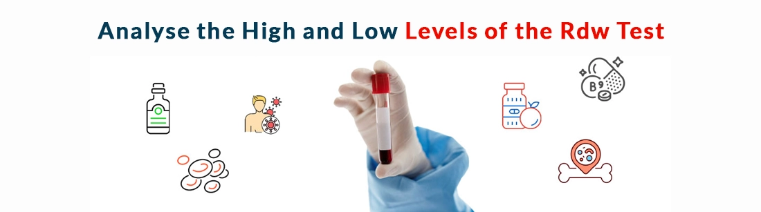 Analyse the High and Low Levels of the Rdw Test